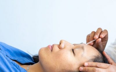 5 Reasons TCM Practitioners use Acupuncture